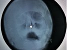Rolling Stones - Angie X-RAY USSR ROENTGEN Bones Record SKULL