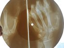 NINA SIMONE - FEELING GOOD - USSR GEORGIAN X-RAY ROENTGEN HAND BONES RECORD