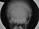Everly Brothers - Let It Be Me X-RAY USSR ROENTGEN Bones Records SKULL