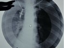 Rolling Stones - Come on X-RAY USSR ROENTGEN Bones Records