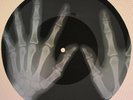 Chuck Berry - Brown Eyed Handsome Man X-RAY USSR ROENTGEN Bones Records