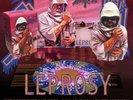 Death Leprosy Bust + LP Deluxe Package Limited 500 Metal Slayer Obituary Sodom