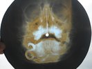 STEPPENWOLF - BORN TO BE WILD - UNIQUE USSR GEORGIAN X-RAY ROENTGEN SKULL RECORD