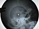 Bob Marley - Get Up Stand Up X-RAY USSR ROENTGEN Bones Records SKULL
