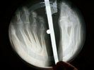 PRESLEY ALL SHOOK UP X-RAY USSR VINYL RECORD MUSIC ON BONES ROENTGEN