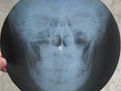 JOHN KAY AND THE SPARROW - GOIN TO CALIFORNIA - USSR X-RAY ROENTGEN SKULL RECORD