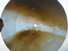 THE WHO - HAPPY JACK - UNIQUE USSR GEORGIAN X-RAY ROENTGEN BONES RECORD