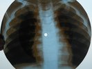 DODIE STEVENS - MERRY CHRISTMAS - USSR GEORGIAN UNIQUE X-RAY BONES RECORD