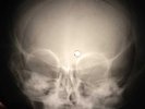 Elvis Presley - Blue Christmas X-RAY BONE OF THE USSR X-RAY RECORDING