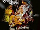 Dazed And Confused: The Yardbirds In `68 + Live At The Bbc (UK IMPORT) VINYL NEW