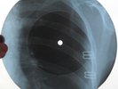DEEP PURPLE - HUSH - USSR GEORGIAN UNIQUE X-RAY ROENTGEN RIBS RECORD