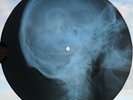 ELLA FITZGERALD - SOLID AS A ROCK - UNIQUE USSR GEORGIAN X-RAY SKULL RECORD