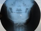 BRUCE SPRINGSTEEN - GROWIN UP - USSR GEORGIAN UNIQUE X-RAY ROENTGEN BONES RECORD