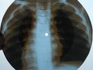 DODIE STEVENS - MERRY CHRISTMAS - USSR GEORGIAN UNIQUE X-RAY BONES RECORD