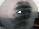 USSR GEORGIAN X-RAY ROENTGEN SKULL  RECORD  UNIQUE ITEM