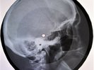 Velvet Underground - Thats The Story Of My Life X-RAY OF THE USSR BONE X-RAY 9.0
