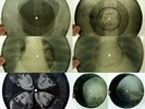 X-RAY 7x 78rpm SOKOLSKIS WERTINSKY & Deep Purple USSR ROENTGEN BONES Ribs Skulls