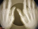 Supremes - You Keep Me Hangin' On X-RAY SKULL USSR BONE RECORDING X-RAY