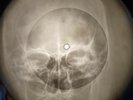 Rolling Stones - As Tears Go By  X-RAY SKULL USSR BONE RECORDING X-RAY