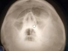 Buddy Holly - Peggy Sue X-RAY SKULL USSR BONE RECORDING X-RAY