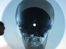 CARL PERKINS - BLUE SUEDE SHOES - USSR GEORGIAN X-RAY ROENTGEN SKULL RECORD