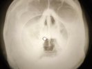 Rolling Stones - Ruby Tuesday  X-RAY USSR BONE RECORD X-RAY