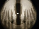 Rolling Stones - Blue Turns to Grey X-RAY OF THE USSR X-RAY BONE RECORDING