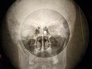 Everly Brothers - Cathy's Clown X-RAY OF THE USSR X-RAY BONE RECORD