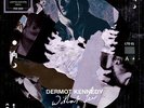 Dermot Kennedy - Without Fear Vinyl LP Picture Disc RSD 2020 Neu