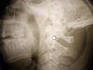 Rolling Stones - Blue Turns To Grey X-RAY OF USSR X-RAY BONE RECORD