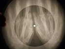 Doors - Hello, I Love You X-RAY OF THE USSR X-RAY BONE RECORDING