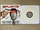 Implants 