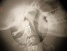 Rolling Stones - Honky Tonk Women X-RAY OF USSR X-RAY BONE RECORD