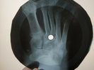 BEATLES PLEASE  PLEASE ME X-Ray USSR Record Roentgen Bones Ribs Music Vinyl