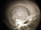 Rolling Stones - As Tears Go By X-RAY OF THE USSR X-RAY BONES RECORD