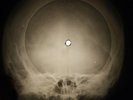 Everly Brothers - Let It Be Me X-RAY OF  USSR X-RAY BONES RECORDING