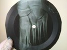 LED ZEPPELIN IMMIGRANT SONG X-Ray USSR Record Roentgen Bones Ribs Music Vinyl