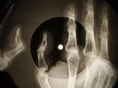 Monkees - Daydream Believer X-RAY OF USSR X-RAY BONES RECORD