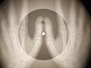 Bob Dylan - I Want You X-RAY OF USSR X-RAY BONES RECORDING