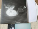 Alice Phoebe Lou  - Glow - **Signed 12'' White Vinyl Album + Lyric Book