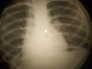 Dion - Lonely Teenager X-RAY OF THE USSR X-RAY BONES RECORD