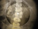 Beatles - Rock and Roll Music X-RAY OF THE USSR X-RAY BONES RECORDING