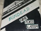 The Undead NEW Nine Toes Later 7