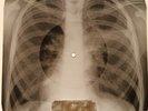 Roy Orbison - Dream Baby X-RAY OF USSR X-RAY BONES RECORD