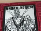 Broken Bones Dem Bones LP Vinyl 1984 Fallout Fall 28 Hardcore Punk UK82 EX