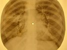 Creedence Clearwater Revival - Proud Mary X-RAY OF USSR X-RAY BONE RECORD