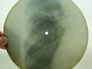 X-RAY 78rpm PETER LESHCHENKO - Andrjuscha Foxtrot USSR ROENTGEN BONES Ribs 1950s