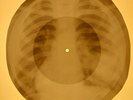 Kingsmen - Louie Louie X-RAY OF THE USSR X-RAY BONES RECORD