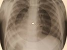 Everly Brothers - Cathy's Clown X-RAY OF USSR X-RAY BONE RECORDING
