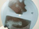 ROLLING STONES POISON IVY X-Ray USSR Record Roentgen Bones Ribs Music Vinyl